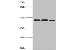 Western blot All lanes: Eukaryotic initiation factor 4A-I antibody at 3 μg/mL Lane 1: K562 whole cell lysate Lane 2: Hela whole cell lysate Lane 3: Rat brain tissue Secondary Goat polyclonal to rabbit IgG at 1/10000 dilution Predicted band size: 47, 40 kDa Observed band size: 47 kDa (EIF4A1 Antikörper  (AA 167-406))