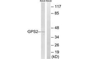 Western blot analysis of extracts from RAW264. (GPS2 Antikörper  (AA 11-60))