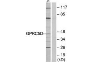 Western Blotting (WB) image for anti-G Protein-Coupled Receptor, Family C, Group 5, Member D (GPRC5D) (AA 271-320) antibody (ABIN2890864) (GPRC5D Antikörper  (AA 271-320))