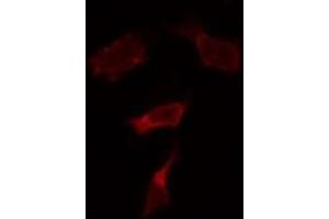 ABIN6274051 staining HepG2 by IF/ICC. (TLR9 Antikörper  (Internal Region))