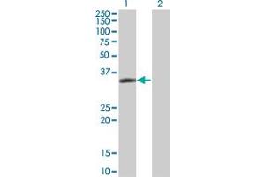 Western Blot analysis of LASP1 expression in transfected 293T cell line by LASP1 monoclonal antibody (M05), clone 4F5. (LASP1 Antikörper  (AA 1-261))
