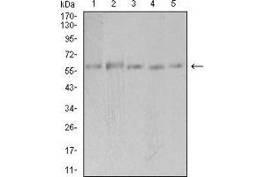 Western blot analysis using PAK3 mouse mAb against Hela (1), SK-N-SH (2), T47D (3), COS7 (4), and HepG2 (5) cell lysate. (PAK3 Antikörper  (AA 1-100))