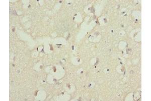 Immunohistochemistry of paraffin-embedded human brain tissue using ABIN7169260 at dilution of 1:100