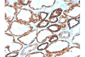Formalin-fixed, paraffin-embedded human kidney stained with Biotin-conjugated CDH16Mouse Monoclonal Antibody (CDH16/2125). (Cadherin-16 Antikörper  (AA 371-507) (Biotin))