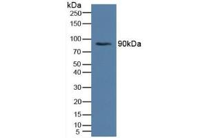 Western blot analysis of Human Serum. (Insulin Receptor Antikörper  (AA 622-945))