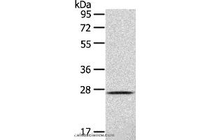 Western blot analysis of 293T cell , using CLEC4D Polyclonal Antibody at dilution of 1:123 (CLEC4D Antikörper)