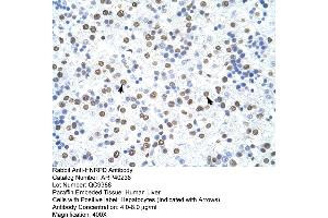 Rabbit Anti-HNRPD Antibody  Paraffin Embedded Tissue: Human Liver Cellular Data: Hepatocytes Antibody Concentration: 4. (HNRNPD/AUF1 Antikörper  (C-Term))