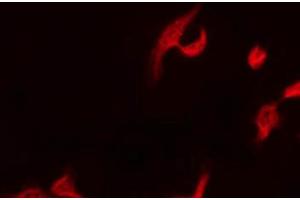 Immunofluorescence (fixed cells) (IF/ICC) image for anti-Docking Protein 1, 62kDa (Downstream of tyrosine Kinase 1) (DOK1) (pTyr362) antibody (ABIN6256717)