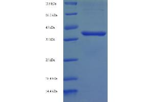 SDS-PAGE (SDS) image for B-Cell CLL/lymphoma 10 (BCL10) (AA 1-233), (full length) protein (His-SUMO Tag) (ABIN5709123) (BCL10 Protein (AA 1-233, full length) (His-SUMO Tag))
