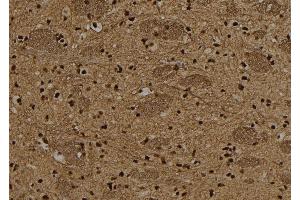 ABIN6265487 and ABIN6278641 at 1/100 staining Rat brain tissue by IHC-P. (T-Box 15/18 Antikörper  (Internal Region))