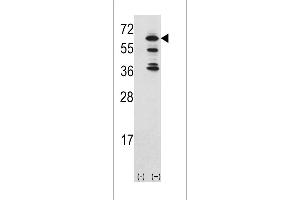 Western blot analysis of ACK1 (arrow) using rabbit polyclonal ACK1 Antibody (Center) (ABIN392084 and ABIN2841843). (TNK2 Antikörper  (AA 383-411))