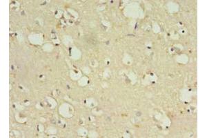 Immunohistochemistry of paraffin-embedded human brain tissue using ABIN7176501 at dilution of 1:100 (ZNF699 Antikörper  (AA 19-195))
