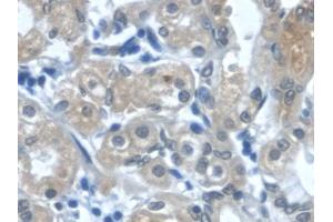 Immunohistochemistry (IHC) image for anti-Transforming Growth Factor, alpha (TGFA) (AA 24-98) antibody (ABIN7425710)