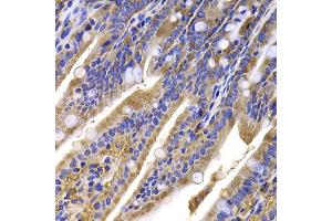 Immunohistochemistry of paraffin-embedded mouse ileum using HDGFRP2 antibody (ABIN5975300) at dilution of 1/100 (40x lens). (HDGFRP2 Antikörper)