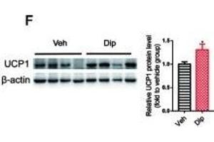 Western Blotting (WB) image for anti-Uncoupling Protein 1 (Mitochondrial, Proton Carrier) (UCP1) (AA 1-307) antibody (ABIN6149883)
