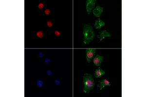 ABIN7093949 and ABIN7097993 staining Hela cells by IF/ICC. (EGLN3 Antikörper  (Internal Region))