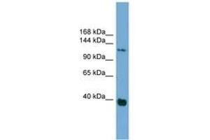 Image no. 1 for anti-Catenin (Cadherin-Associated Protein), delta 1 (CTNND1) (AA 827-876) antibody (ABIN6744923) (CTNND1 Antikörper  (AA 827-876))