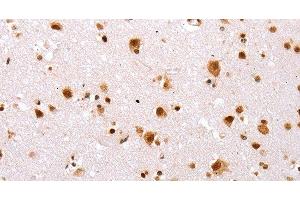 Immunohistochemistry of paraffin-embedded Human brain tissue using TBX2 Polyclonal Antibody at dilution 1:32 (TBX2 Antikörper)