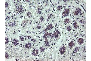 Immunohistochemical staining of paraffin-embedded Human breast tissue using anti-SCFD1 mouse monoclonal antibody. (SCFD1 Antikörper)