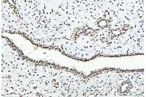 IHC analysis of CTBP2 using anti-CTBP2 antibody (ABIN7601325).