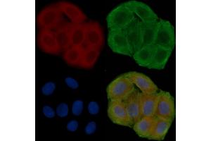 ABIN6258193 and ABIN6276039 staining Hela cells(30 min of UV treatment) by IF/ICC. (GPR83 Antikörper  (N-Term))
