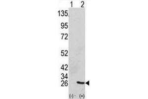 Western blot analysis of GRB2 antibody and 293 cell lysate (2 ug/lane) either nontransfected (Lane 1) or transiently transfected with the GRB2 gene (2). (GRB2 Antikörper  (AA 89-118))