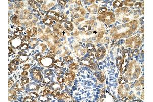 C3orf31 antibody was used for immunohistochemistry at a concentration of 4-8 ug/ml to stain Epithelial cells of renal tubule (arrows) in Human Kidney. (TAM41 Antikörper  (N-Term))