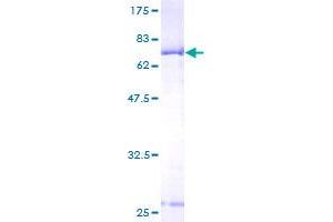 BCKDK Protein (AA 28-412) (GST tag)