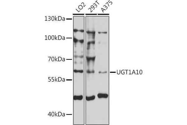 UGT1A10 antibody  (AA 50-150)