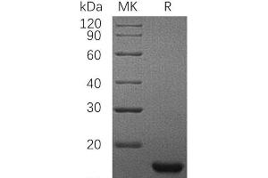 Western Blotting (WB) image for KIT Ligand (KITLG) protein (His tag) (ABIN7321261) (KIT Ligand Protein (KITLG) (His tag))