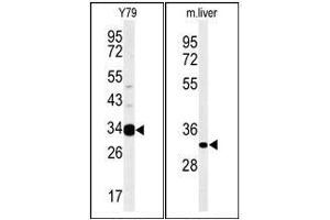 Western blot analysis: AIG1 Antibody staining of Mouse liver tissue lysates (Right) and Y79 cell line lysates (Left) (35 ug/lane).