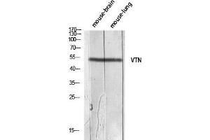 Western Blot (WB) analysis of Mouse Brain Mouse Lung lysis using VTN antibody. (Vitronectin Antikörper)