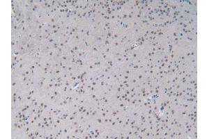 IHC-P analysis of Mouse Brain Tissue, with DAB staining. (IL-2 Antikörper  (AA 10-169))
