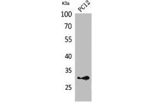 Western Blot analysis of PC12 cells using HLA-DQB1/2 Polyclonal Antibody. (HLA-DQB2 Antikörper  (Internal Region))