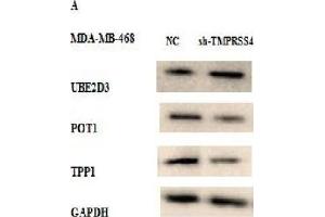 Western Blot Analysis was Performed to Study the Effect of TMPRSS4 Expression Modulation on Telomere Integrity in Stably Transfected MDA-MB-468 and MCF-7 Cell Lines by Analyzing the Expression of Certain Proteins Related to Telomere Maintenance (UBE2D3, POT1, and TPP1). (TPP1 Antikörper  (AA 284-563))