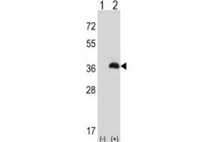Western Blotting (WB) image for anti-Peroxisomal Biogenesis Factor 16 (PEX16) antibody (ABIN3004053) (PEX16 Antikörper)