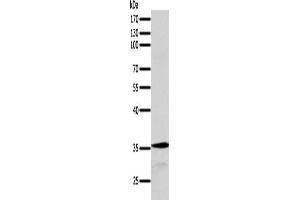 Gel: 10 % SDS-PAGE, Lysate: 40 μg, Lane: MCF7 cells, Primary antibody: ABIN7131278(SYT9 Antibody) at dilution 1/200, Secondary antibody: Goat anti rabbit IgG at 1/8000 dilution, Exposure time: 1 minute (SYT9 Antikörper)