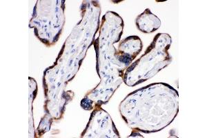 IHC analysis of AEBP2 using anti-AEBP2 antibody (ABIN4886435). (AEBP2 Antikörper  (AA 424-517))