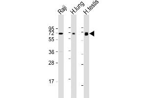 All lanes : Anti-ERVK-7 Antibody (N-Term) at 1:1000-1:2000 dilution Lane 1: Raji whole cell lysate Lane 2: human lung lysate Lane 3: human testis lysate Lysates/proteins at 20 μg per lane. (ERVK-7 Antikörper  (AA 96-128))
