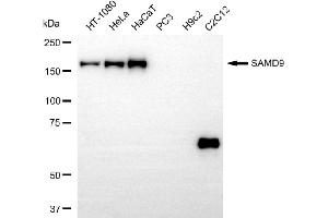 Western blotting analysis using SAMD9 antibody (ABIN7800437).