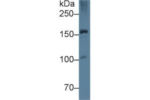 Western Blot; Sample: Rat Liver lysate; Primary Ab: 5µg/ml Mouse Anti-Rat APOB Antibody Second Ab: 0. (APOB Antikörper  (AA 2747-2913))