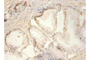Immunohistochemistry of paraffin-embedded human prostate tissue using ABIN7163321 at dilution of 1:100 (PLA2G2A Antikörper  (AA 21-144))