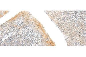 Immunohistochemistry of paraffin-embedded Human tonsil tissue using FAM110D Polyclonal Antibody at dilution of 1:60(x200) (GRRP1 Antikörper)