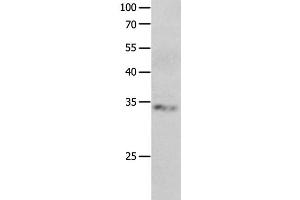 Western Blot analysis of Jurkat cell using RBFOX3 Polyclonal Antibody at dilution of 1:550 (NeuN Antikörper)