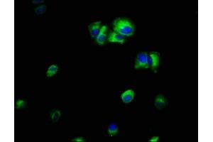 Immunofluorescence staining of MCF-7 cells with ABIN7156505 at 1:66, counter-stained with DAPI. (ILK Antikörper  (AA 1-228))