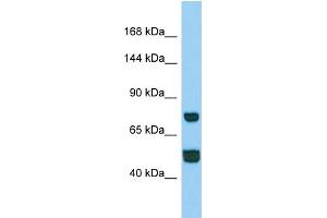 Western Blotting (WB) image for anti-Coiled-Coil Domain Containing 39 (CCDC39) (N-Term) antibody (ABIN2790737)