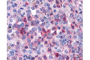Immunohistochemistry (IHC) image for anti-serum/glucocorticoid Regulated Kinase Family, Member 3 (SGK3) (AA 107-156) antibody (ABIN6745757)