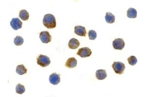 Immunohistochemistry (IHC) image for anti-Toll-Like Receptor 9 (TLR9) (Middle Region) antibody (ABIN1031133)