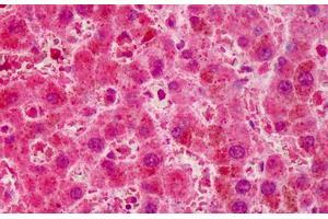 Human Liver: Formalin-Fixed, Paraffin-Embedded (FFPE) (RNF2 Antikörper  (AA 189-201))