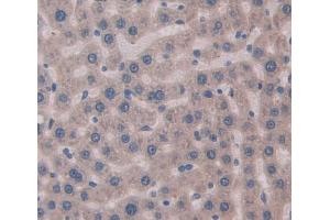 Immunohistochemistry (IHC) image for anti-Myosin Heavy Chain 8, Skeletal Muscle, Perinatal (MYH8) (AA 40-240) antibody (ABIN1859933)